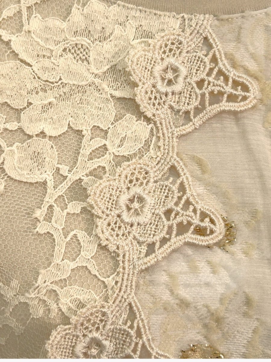 画像7: パッチワークジャガード　チュニック  (7)